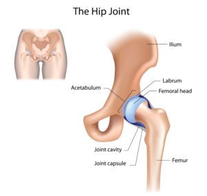 torn hip labrum
