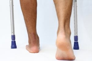 Back View of Man's Ankles While Walking With Crutches